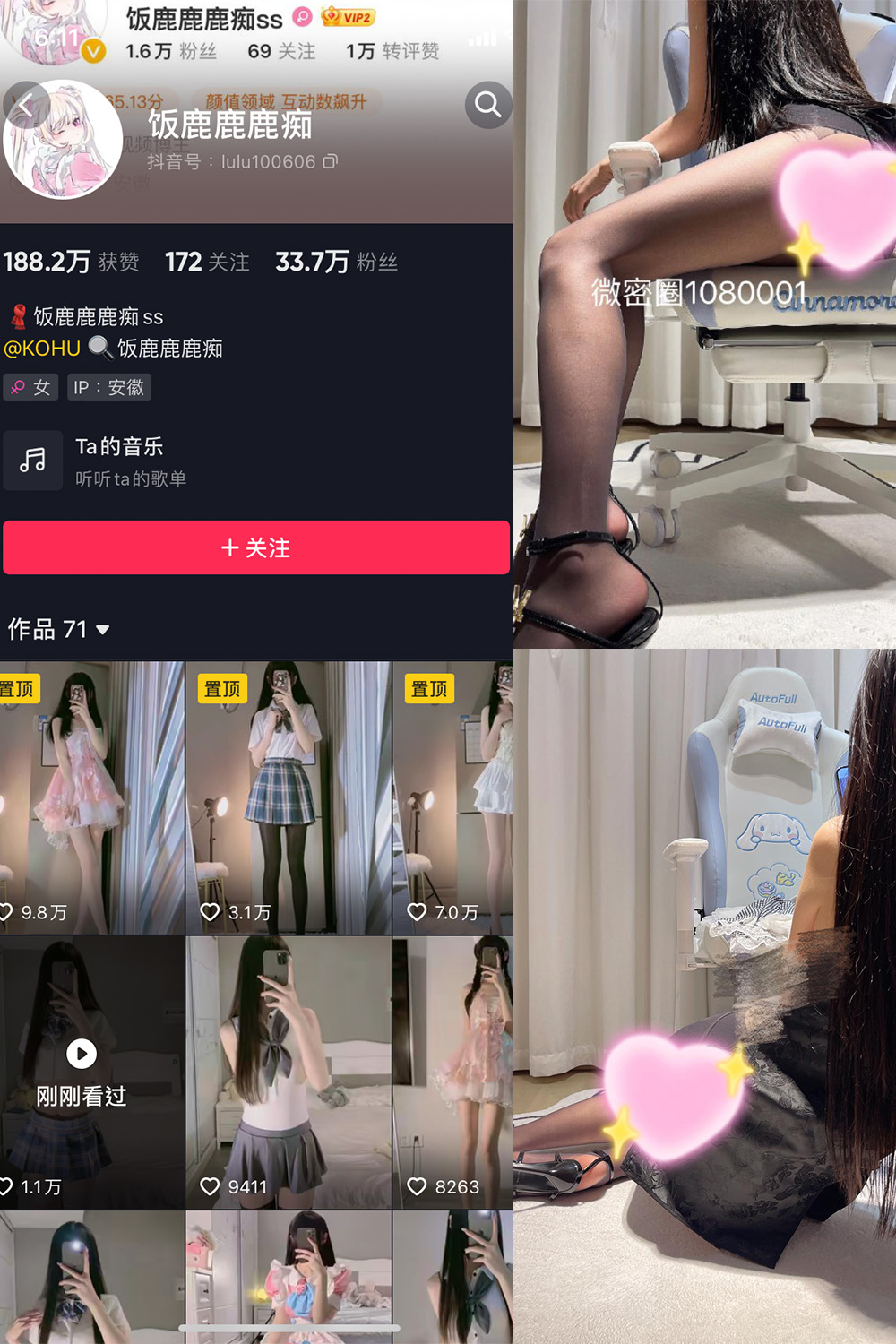 【在线看】抖音 饭鹿鹿痴 微密圈  NO.018期 【9P1V】