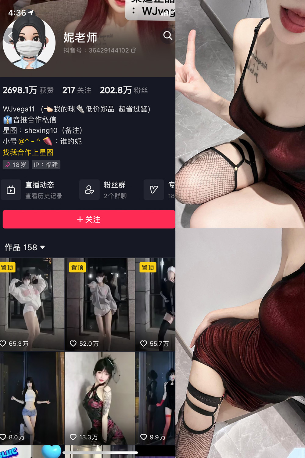 【在线看】抖音 妮老师 微密圈  NO.001期 【21P10V】